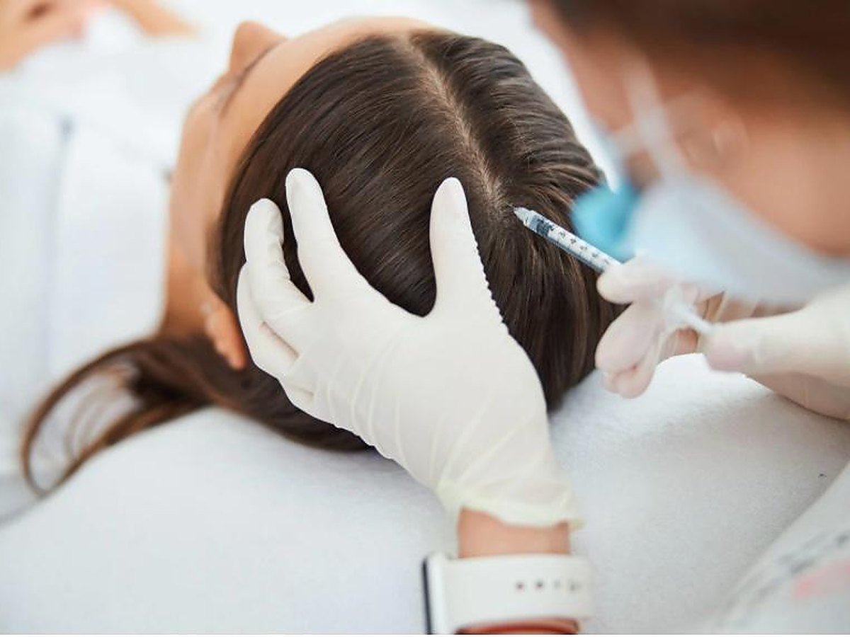 Aplicação de mesoterapia capilar no couro cabeludo